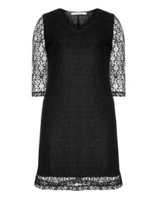 Studio Cotton dress with lace Black